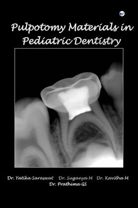 Pulpotomy Materials in Pediatric Dentistry [Paperback] Yatika Saraswat; Suganya M; Kavitha M and Prathima G S