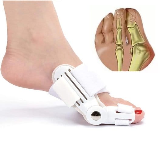 WUGO::Bunion Splint And Bunion Valgus Corrector, Hallux Valgus Corrector, Big Toe Joint, Thumb Support for Pain Relief  (Medically Original Bunion Corrector-1 Pair)