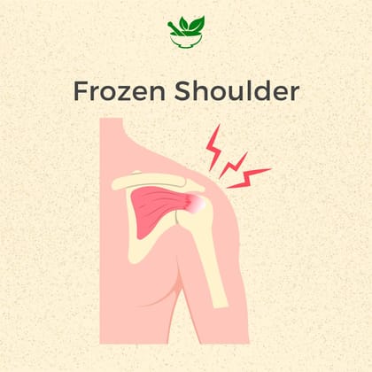 Frozen Shoulder Ayurvedic Management 30 Days Pack