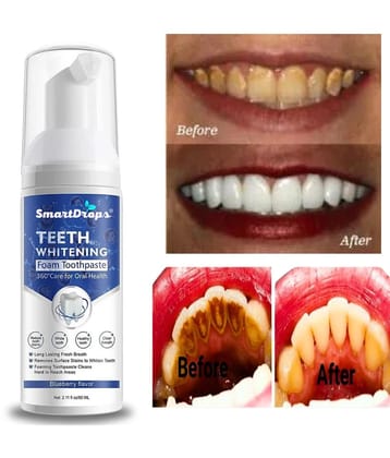 Smartdrops Dentist Recommended Denture Oral Kit