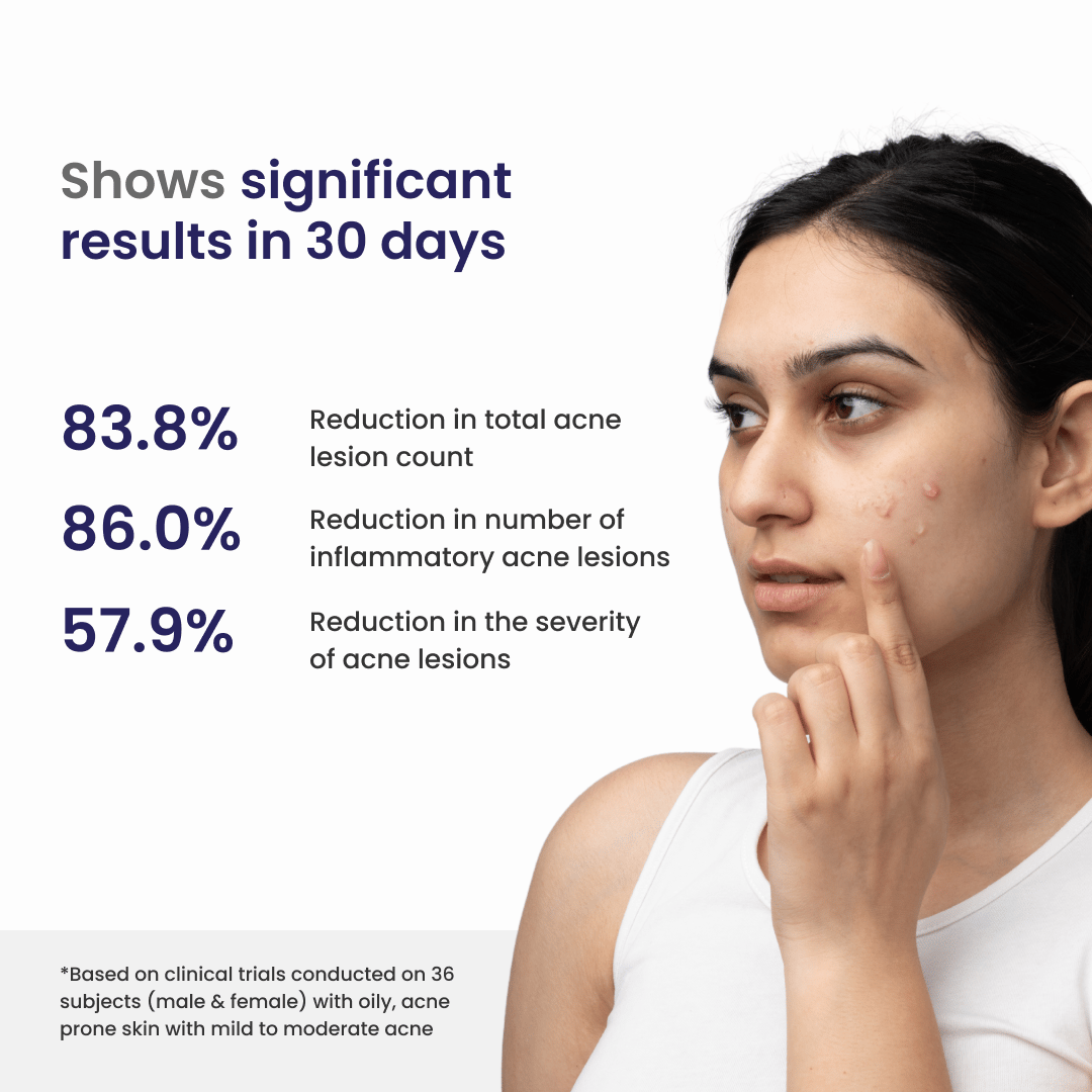 Acne Clarifying Gel with AHA & BHA-20g